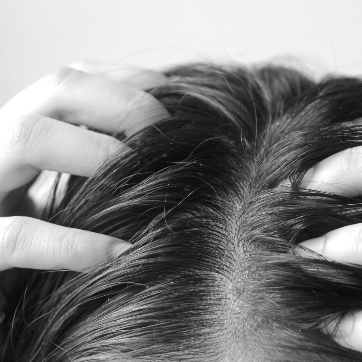 Anti Caspa, Graso, Fortalecimiento, Psoriasis